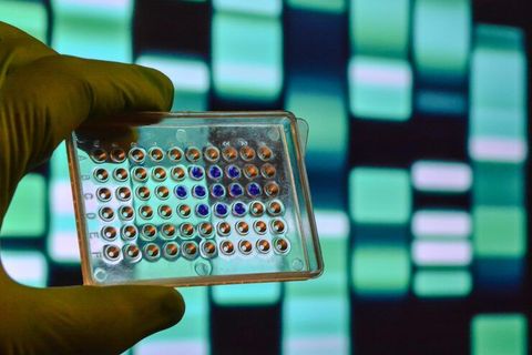 Insights on TNF Alpha ELISA Kit for Advanced Laboratory Research