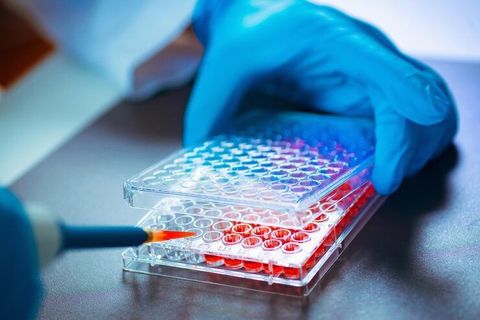 Assay Development Overview: Principles and Practical Workflow